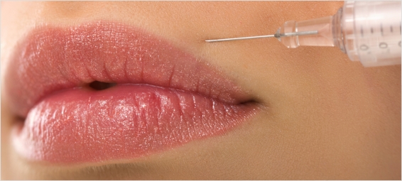 Andrea Ortiz: acido hialurónico para ganar volumen en los labios.