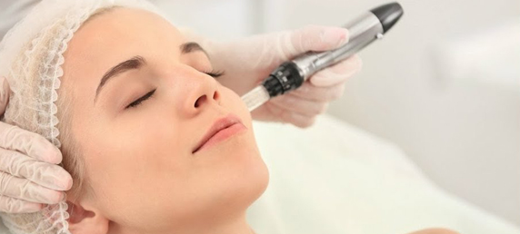 Andrea Ortiz te ofrece dermapen o nanopore.